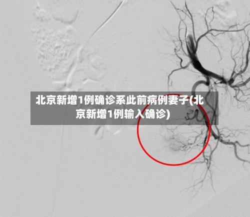北京新增1例确诊系此前病例妻子(北京新增1例输入确诊)-第2张图片