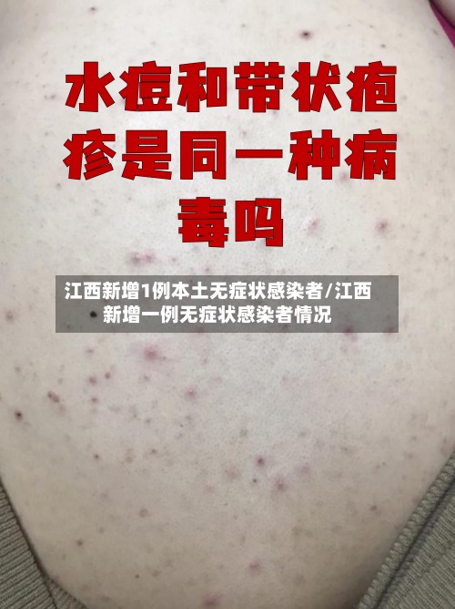 江西新增1例本土无症状感染者/江西新增一例无症状感染者情况