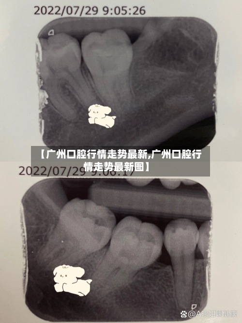 【广州口腔行情走势最新,广州口腔行情走势最新图】-第2张图片