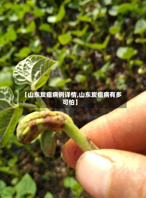 【山东炭疽病例详情,山东炭疽病有多可怕】-第2张图片