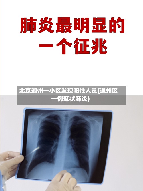 北京通州一小区发现阳性人员(通州区一例冠状肺炎)-第2张图片